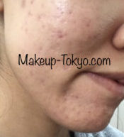 遅延型アレルギー グルテンアレルギーだと思って検査したら 驚きの結果がでたお話 Makeup Tokyo